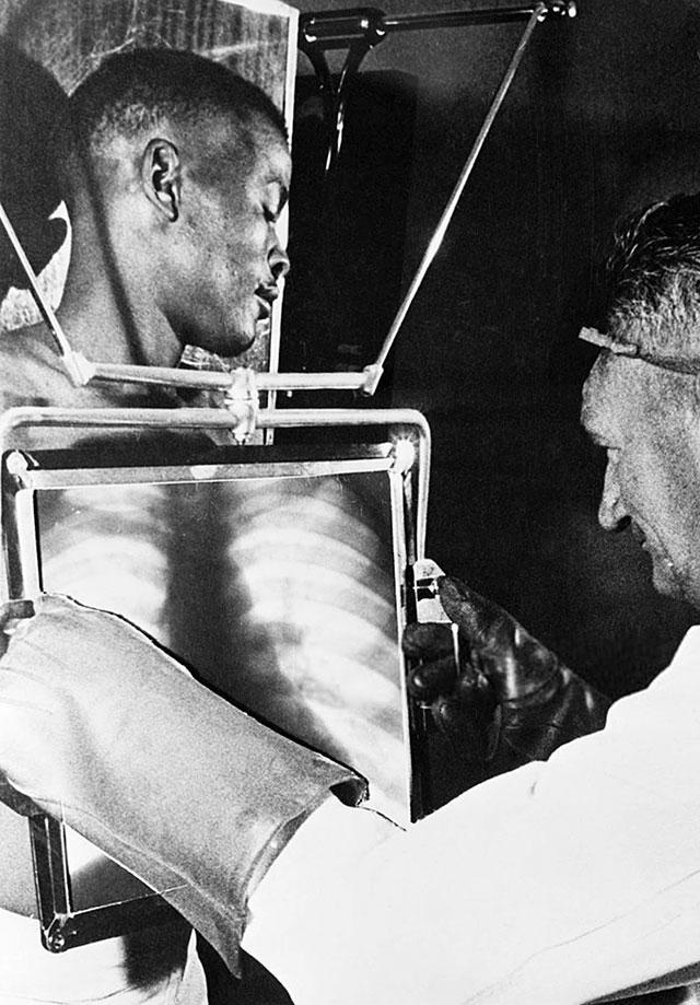 De Beer mine workers are X-rayed at the end of every shift before leaving the diamond mines. Kimberly, South Africa. 1954