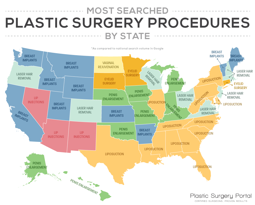 These Are The Most Searched Plastic Surgery Procedures By State