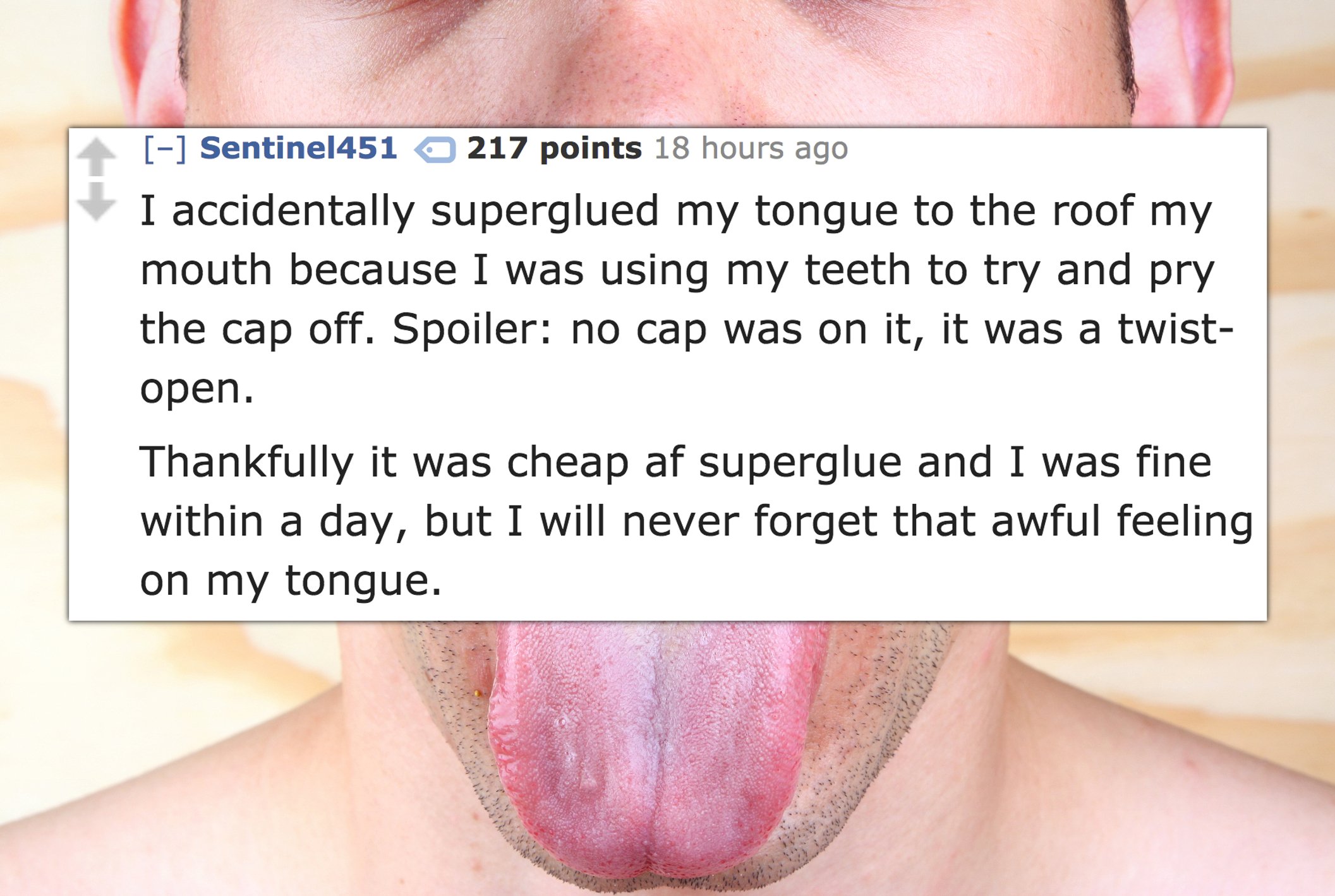 we want you - Sentinel451 217 points 18 hours ago I accidentally superglued my tongue to the roof my mouth because I was using my teeth to try and pry the cap off. Spoiler no cap was on it, it was a twist open. Thankfully it was cheap af superglue and I w