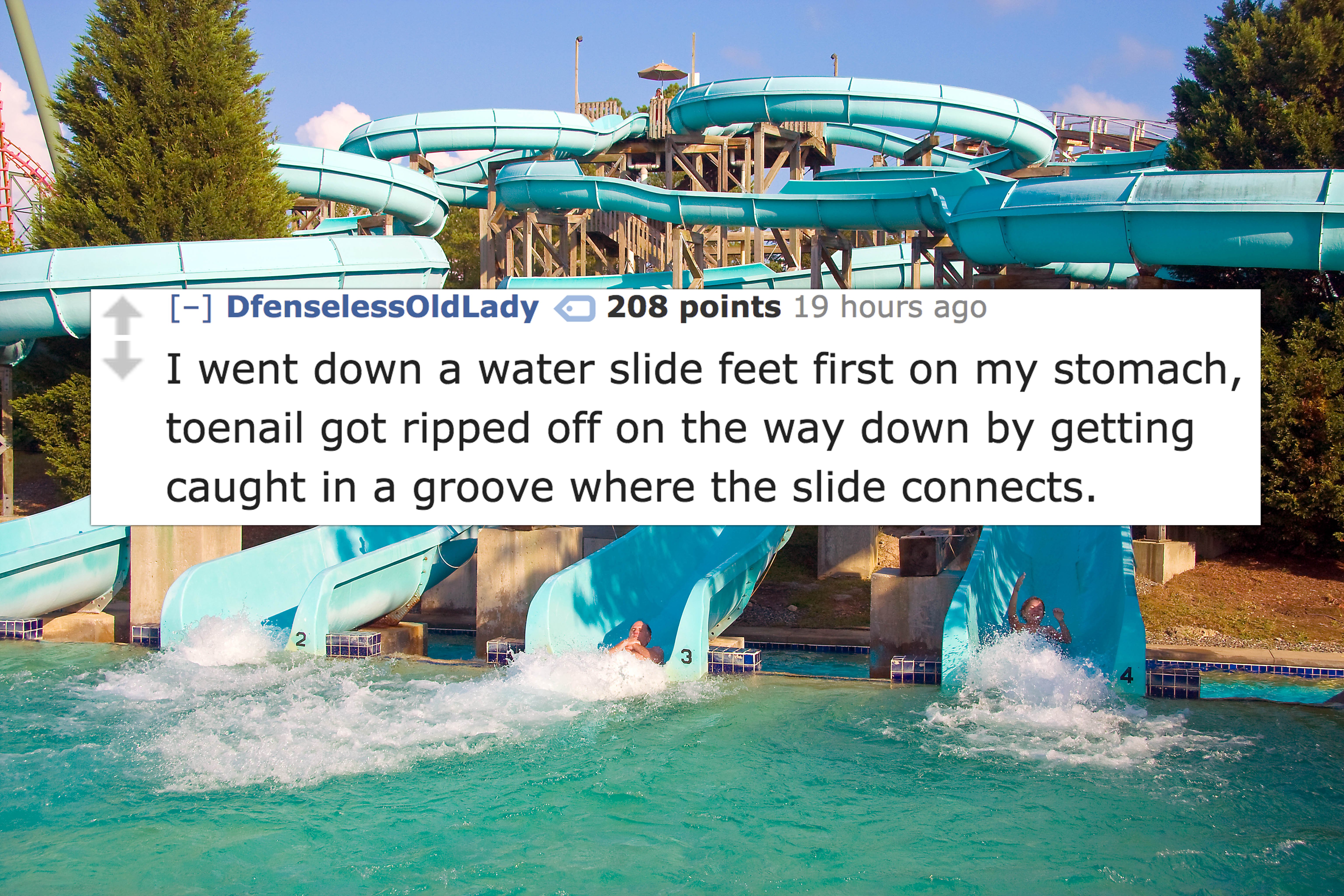 soak city kings dominion water park - DfenselessOldLady 208 points 19 hours ago I went down a water slide feet first on my stomach, toenail got ripped off on the way down by getting caught in a groove where the slide connects.