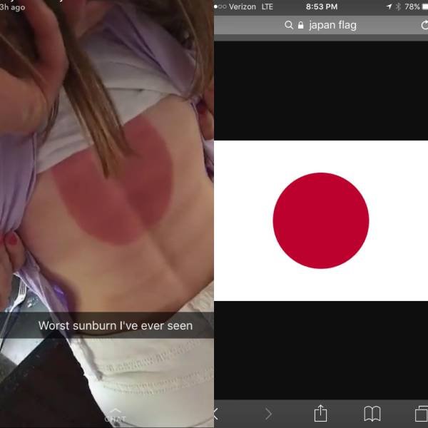 shoulder - 3h ago Verizon Lte 1% 78% QAjapan flag Worst sunburn I've ever seen