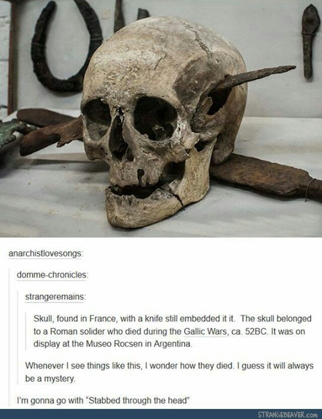 doot doot mr skeltal - anarchistlovesongs dommechronicles strangeremains Skull, found in France, with a knife still embedded it it. The skull belonged to a Roman solider who died during the Gallic Wars, ca. 52BC. It was on display at the Museo Rocsen in A