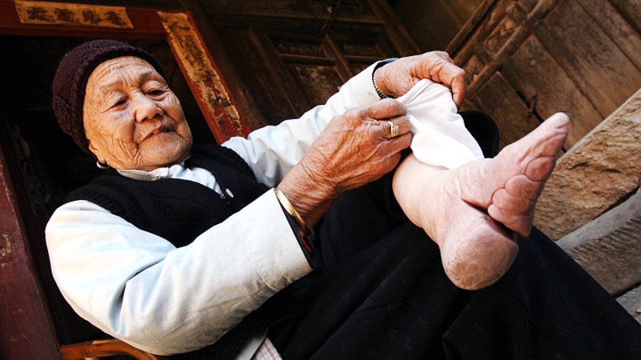 The Last Woman To Follow China’s 1000-Year-Old Foot-Binding Tradition Shows The Damage Done