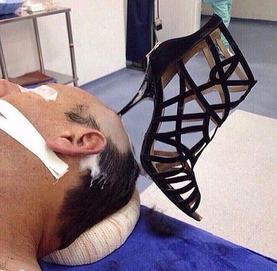 Man with woman's shoe stuck in his head