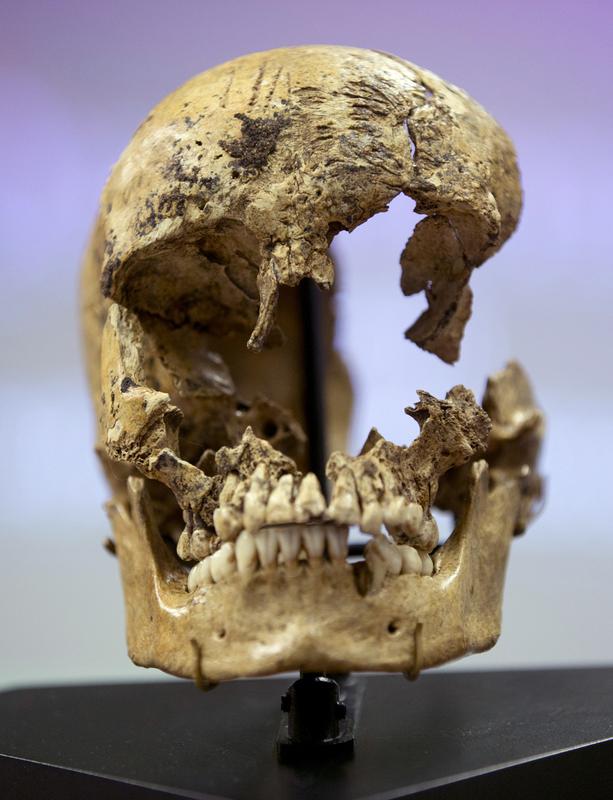 Skull of a 14 year-old girl believed to be a victim of cannibalism at the Jamestown colony in the winter of 1609. Butchery marks can be seen on forehead