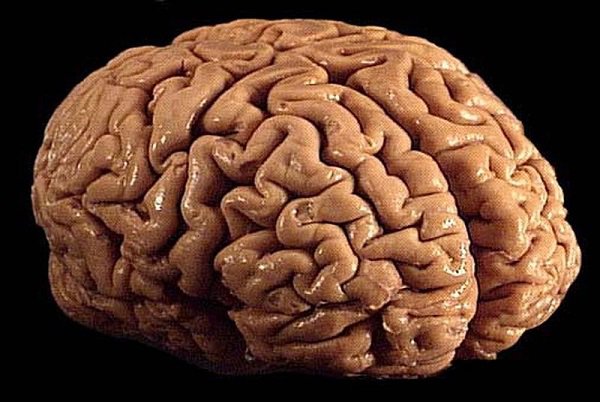 If you took a piece of your brain tissue that was the size of a grain of sand, it would contain 100,000 neurons and 1,000,000,000 synapses, all working with each other.