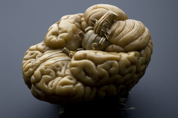 Unlike a computer, your brain doesn’t ‘take up space’ as far as memory goes. The storage capacity of a human brain is virtually unlimited.