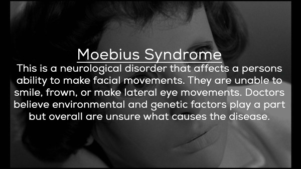 monochrome photography - Moebius Syndrome This is a neurological disorder that affects a persons ability to make facial movements. They are unable to smile, frown, or make lateral eye movements. Doctors believe environmental and genetic factors play a par