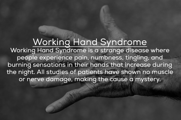 monochrome photography - Working Hand Syndrome Working Hand Syndrome is a strange disease where people experience pain, numbness, tingling, and burning sensations in their hands that increase during the night. All studies of patients have shown no muscle 