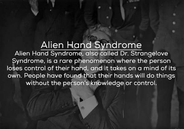 monochrome photography - Alien Hand Syndrome Alien Hand Syndrome, also called Dr. Strangelove Syndrome, is a rare phenomenon where the person loses control of their hand, and it takes on a mind of its own. People have found that their hands will do things