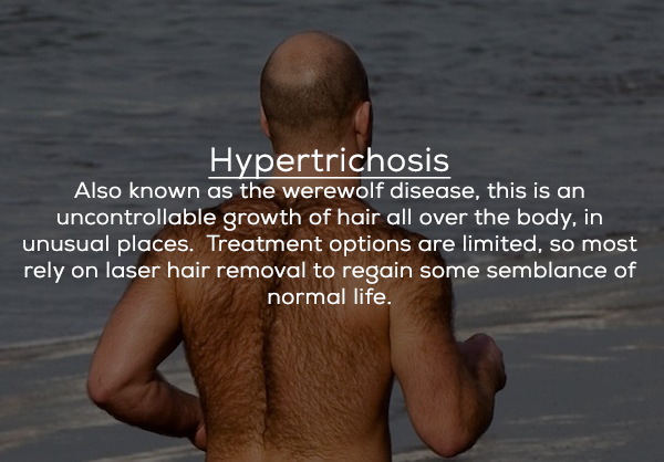 water - Hypertrichosis Also known as the werewolf disease, this is an uncontrollable growth of hair all over the body, in unusual places. Treatment options are limited, so most rely on laser hair removal to regain some semblance of normal life.