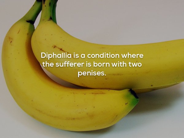 wtf facts - Diphallia is a condition where the sufferer is born with two penises.