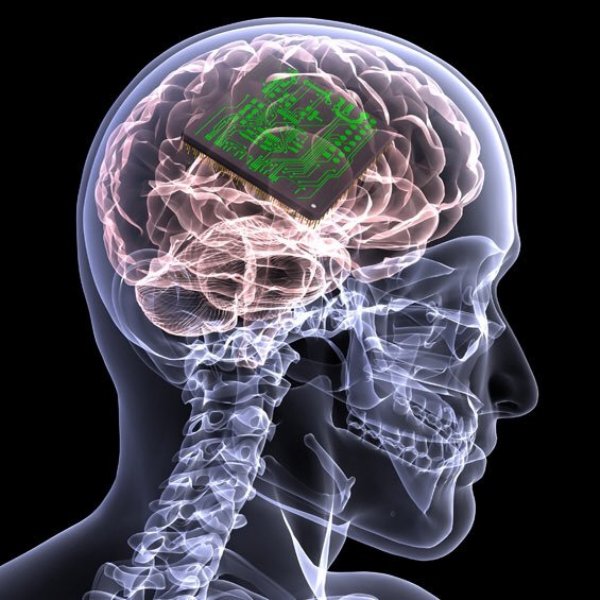 By 2023 brain implants will be available to restore lost memories.