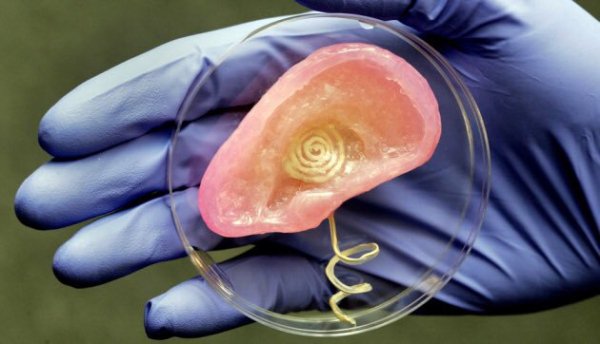 Between 2030-2040 3D printers capable of printing organs will become widely used in hospitals.