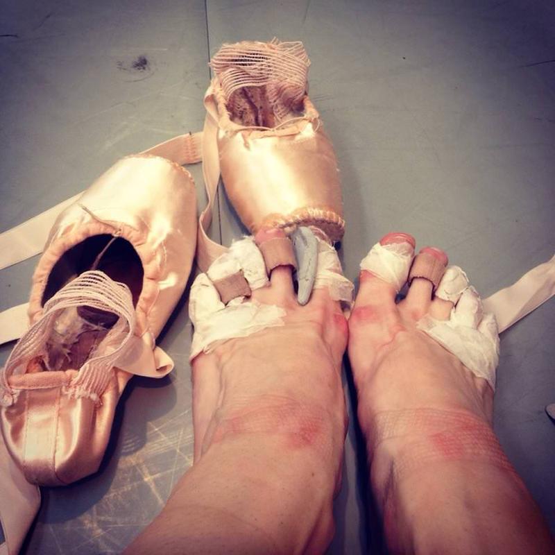 The toll being a ballerina takes on the feet 