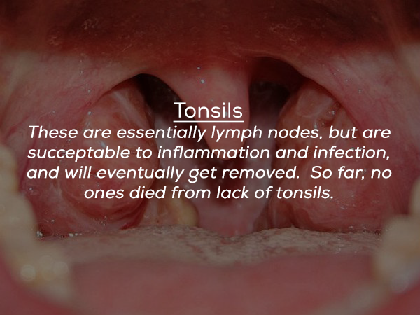 lip - Tonsils These are essentially lymph nodes, but are succeptable to inflammation and infection, and will eventually get removed. So far, no ones died from lack of tonsils.