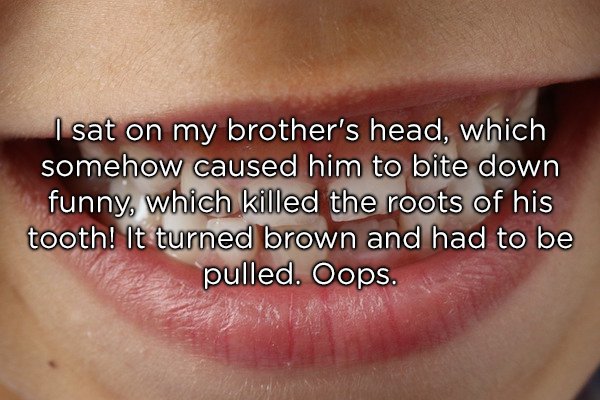 lip - I sat on my brother's head, which somehow caused him to bite down funny, which killed the roots of his tooth! It turned brown and had to be pulled. Oops.