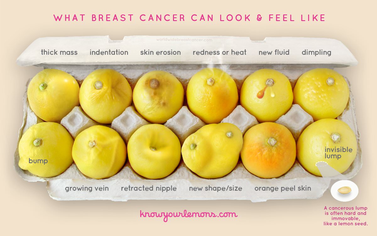 breast cancer look like - What Breast Cancer Can Look & Feel Worldwidebreastcancer.com thick mass indentation skin erosion redness or heat new fluid dimpling invisible lump bump growing vein retracted nipple new shapesize orange peel skin knowyourlemons.c