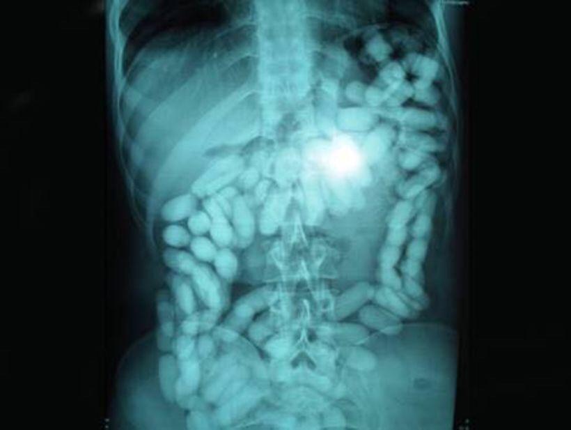 X-ray of a smuggler