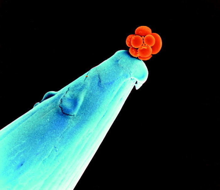 This is an electron micrograph of early embryo on the head of a pin.
