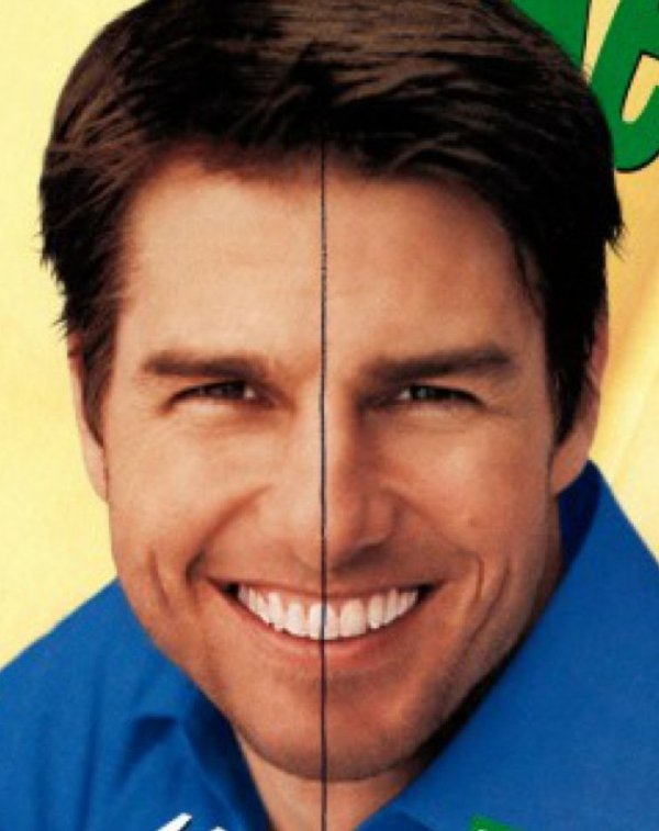 Tom Cruise has one tooth in the center of his face. There’s even memes about ‘Tom Cruise Middle Tooth National Awareness Day’.