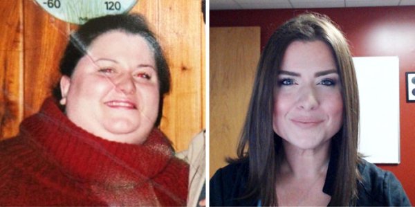 losing weight in the face before and after - 60 120