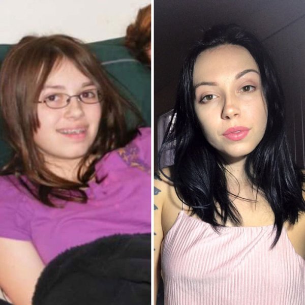 35 Epic Ugly Duckling Transformations To Give You Hope