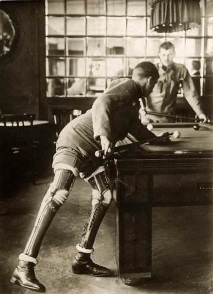 World War I soldier, a double amputee, plays billiards with prosthetic legs, 1915.
