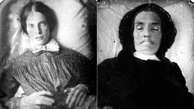 In some cases, the dead didn't seem life-like, so photographers did the following to change that.