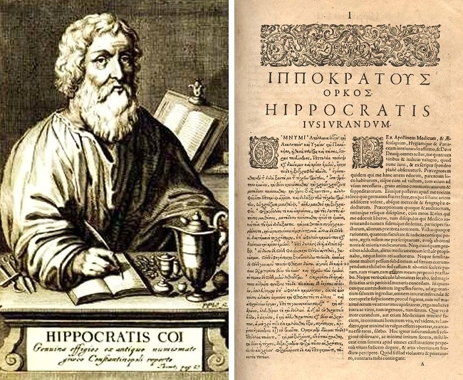 The Hippocratic Oath was not written by Hippocrates.
In the first draft, recorded by Hippocrates, doctors were forbidden to promote abortion and also the concept of “medical secrets” was disclosed. The full version, which we know now, appeared much later than the death of the Greek doctor and philosopher.