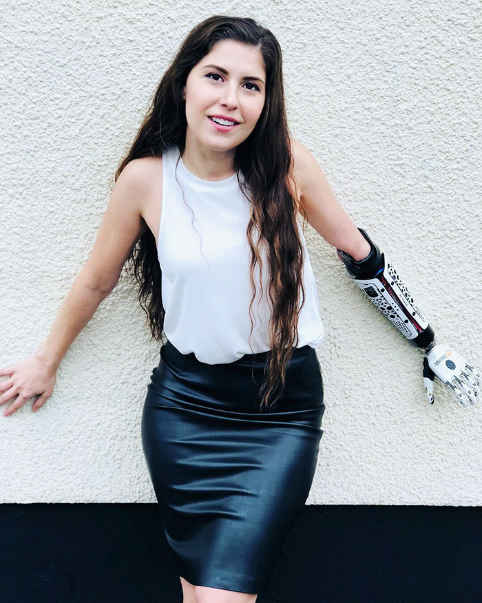 Angel Giuffria became a bionic actress and activist