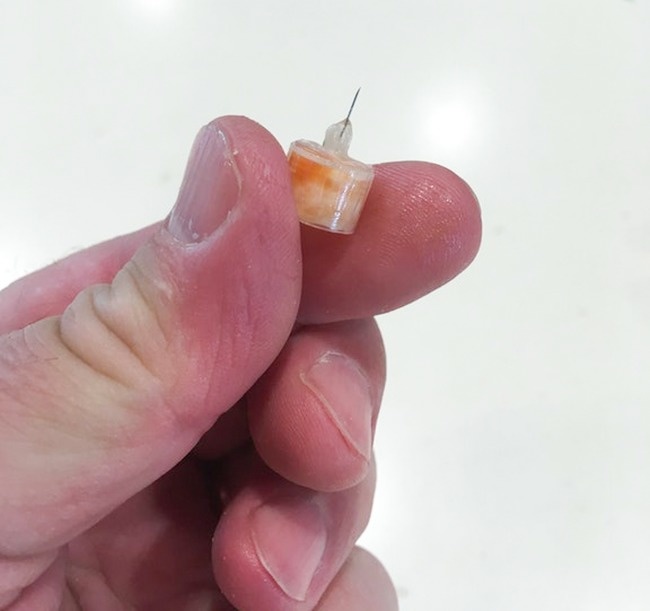 This guy discovered a needle in his McDonald’s hamburger. Luckily he lived to tell the tale.