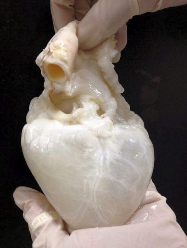 human heart without blood