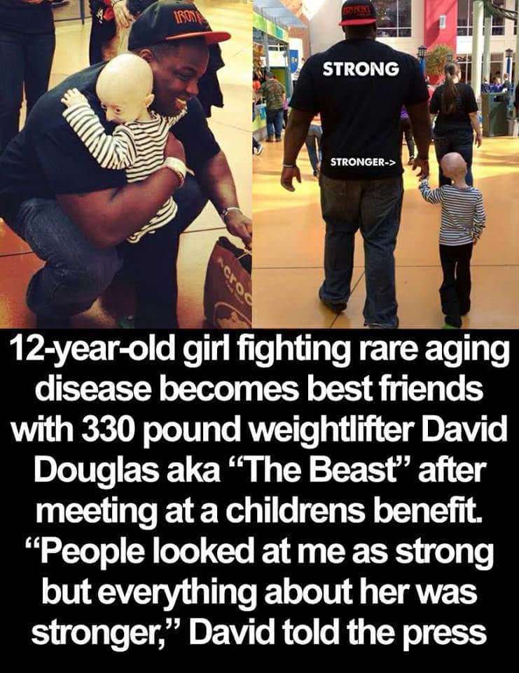 faith in humanity restored - Strong Stronger> 12yearold girl fighting rare aging disease becomes best friends with 330 pound weightlifter David Douglas aka "The Beast" after meeting at a childrens benefit. "People looked at me as strong but everything abo