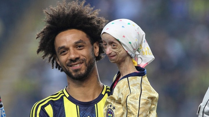 A 13-year-old girl suffering from a rare disease had always dreamed about meeting the players of one of the biggest football teams in Turkey. Her dream came true.