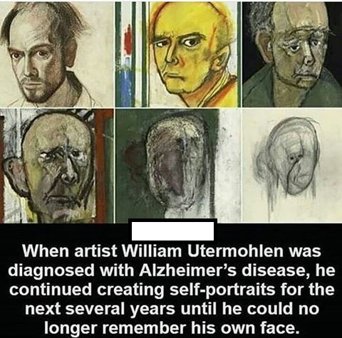 haunting william utermohlen artist with alzheimer's self portraits - When artist William Utermohlen was diagnosed with Alzheimer's disease, he continued creating selfportraits for the next several years until he could no longer remember his own face.