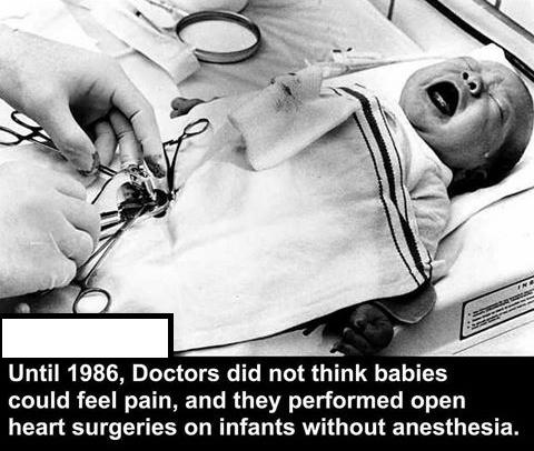 haunting do they cut off in a circumcision - Until 1986, Doctors did not think babies could feel pain, and they performed open heart surgeries on infants without anesthesia.