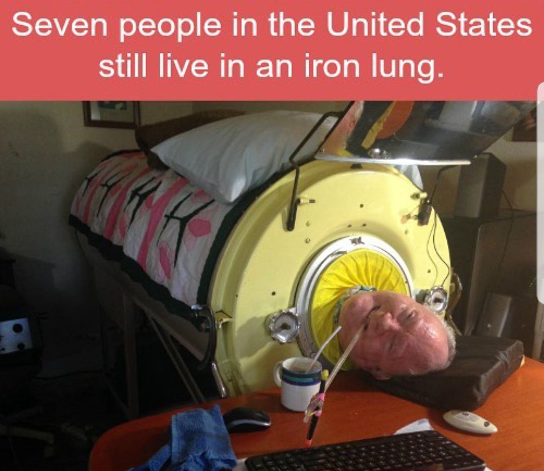 iron lung facts - Seven people in the United States still live in an iron lung.