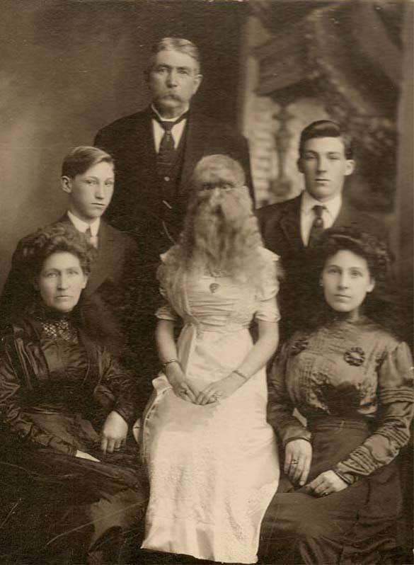 Alice Elizabeth Doherty with her family in Minnesota, US in 1903. She is the only known person with hypertrichosis lanuginosa born in the United States. For her that mean she grew a massive amount of hair all over her face like it was the top of her head.