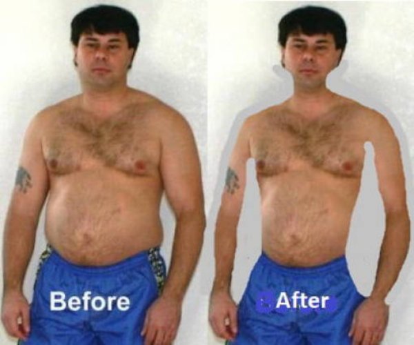 before and after weight loss - Before After