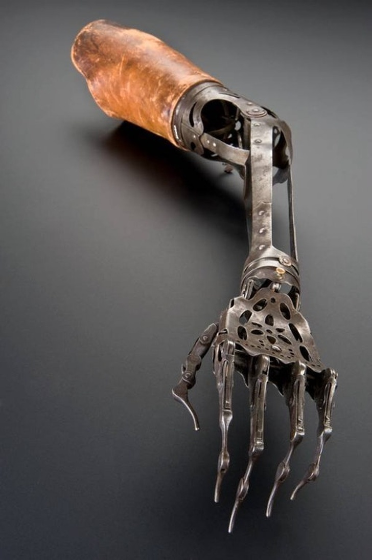 A 150-year-old prosthesis