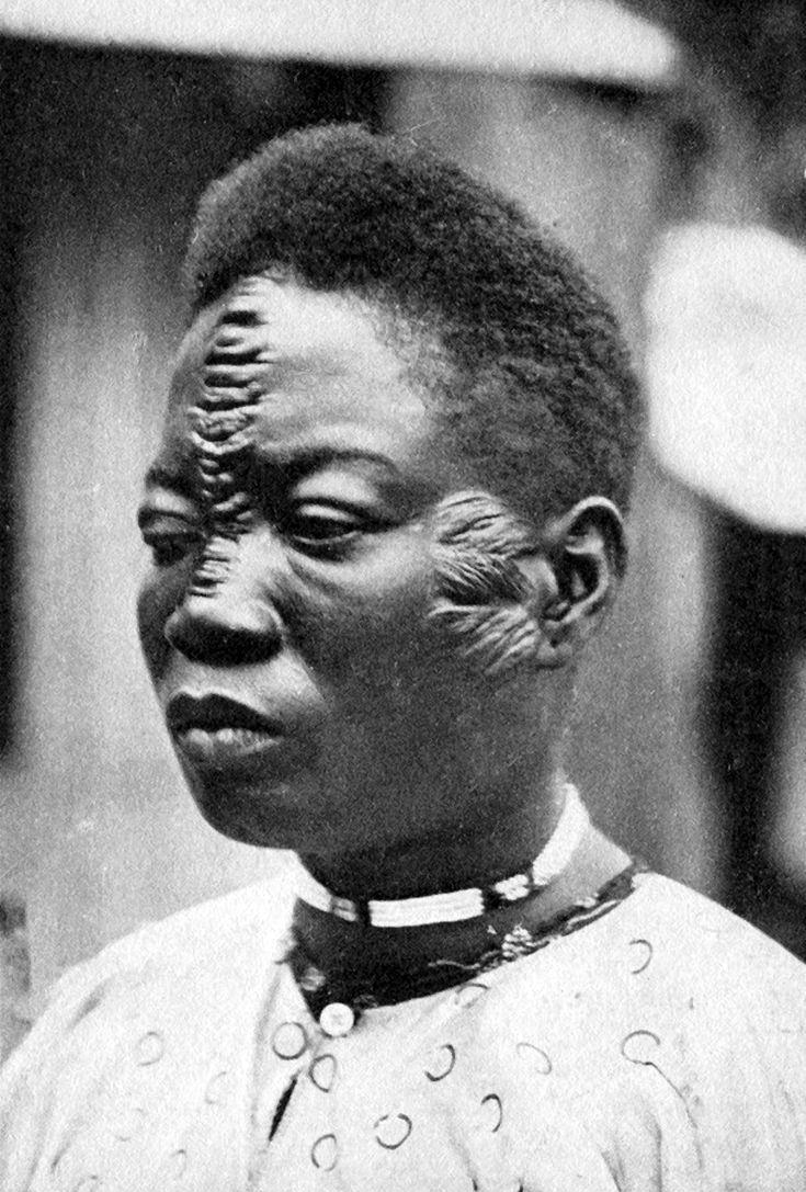 A women who has had the process of scarification done to her face in the Belgian Congo in 1902.