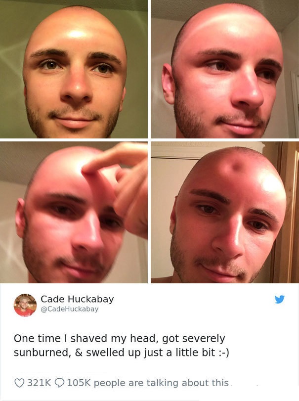 bad luck hey did you know that umm - Cade Huckabay One time I shaved my head, got severely sunburned, & swelled up just a little bit people are talking about this