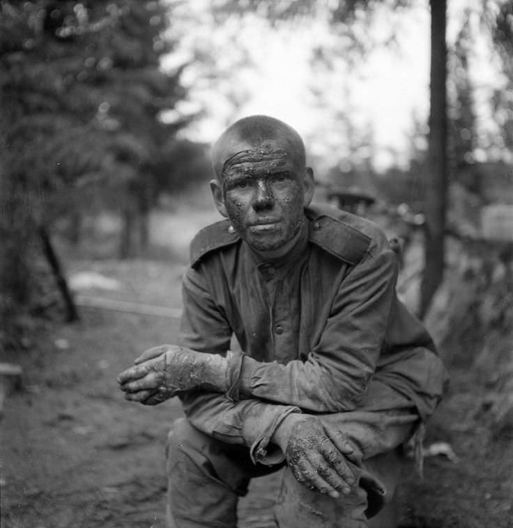 A portrait of a wounded Russian soldier near Finland in 1944.