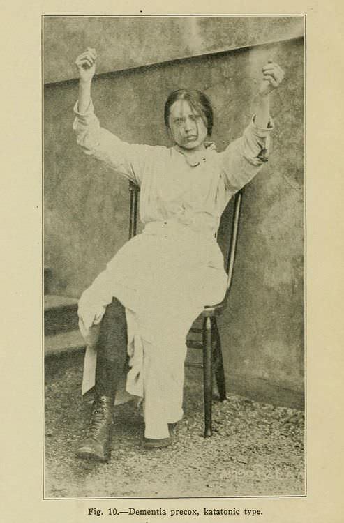 A women with Dementia Precox (Schizophrenia) in the US in 1902.