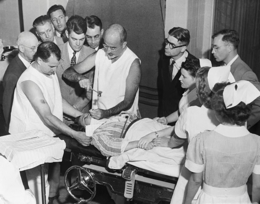 Walter Freeman performing his trademark ice pick lobotomy on a patient in 1956. Freeman traveled the US performing lobotomies for mental patients and others for just $25. He became famous for this. He did not need a neurosurgeon nor did he need much for his procedure. What he would do was insert a metal pick into the corner of each eye-socket, hammering it through the thin bone, and moving it back and forth, which would sever the connections to the prefrontal cortex in the frontal lobes of the brain. He even did this for John and Robert Kennedy's sister Rosemary. The technique was widely criticized, but Freeman continued for 40 years, performing over 4,000 lobotomies with at least 2,500 using this technique. Freeman was not a doctor by the way, and he never took formal surgical training. Worse yet, around 40% of his patients were gay, and the procedure were forced on them by their families to change their sexual orientation. Most patients sadly suffered mental issues after this procedure. That means this guy changed perfectly healthy people to severely disabled with his procedure in an attempt to make them straight or for others making their existing mental issues just that much worse.