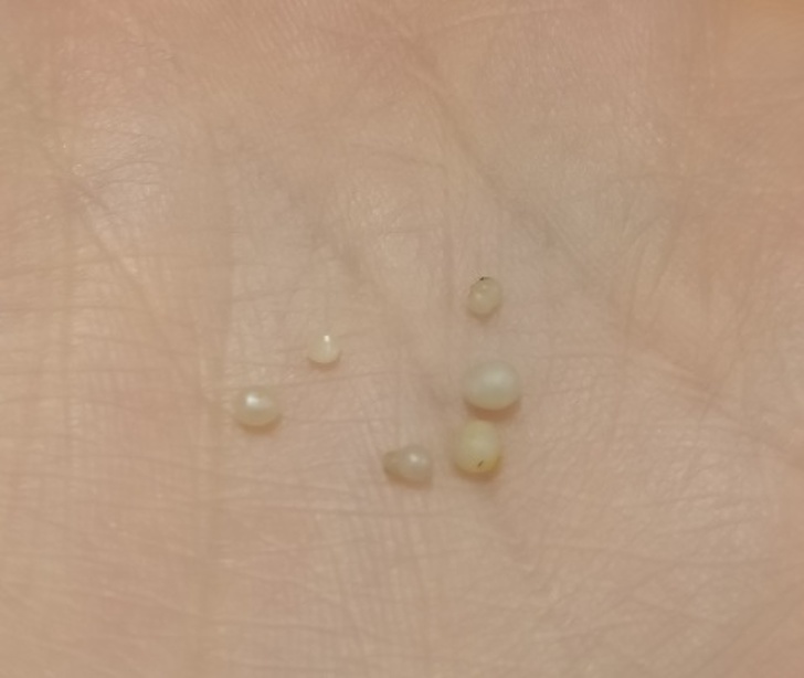 “I found 6 tiny pearls in the mussels I ate!”