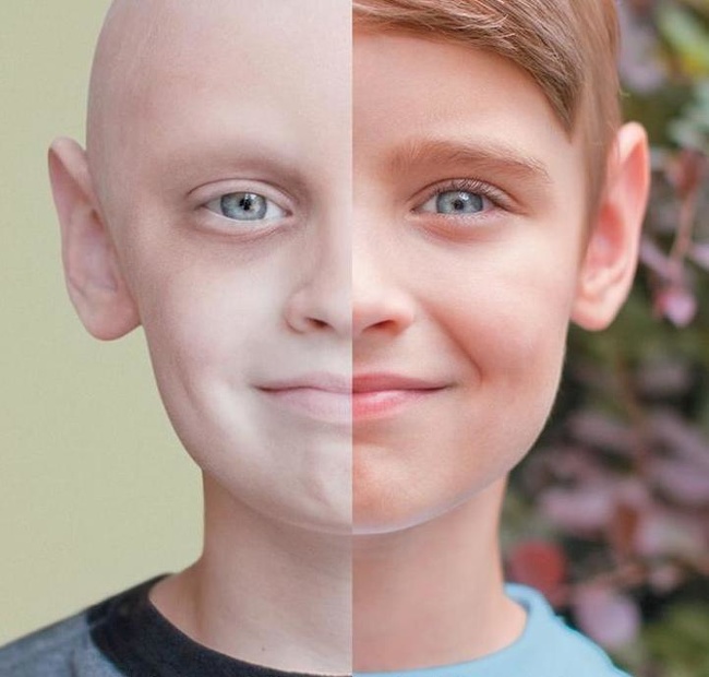Then and now: a boy who managed to defeat cancer