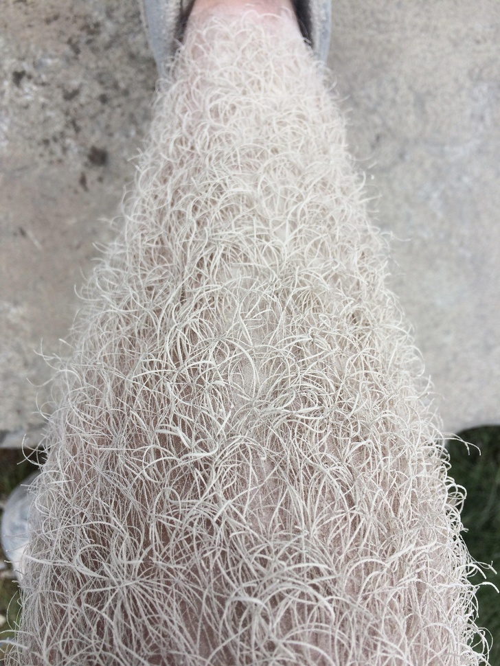 “My leg covered in stone dust after cutting stones for 15 minutes”