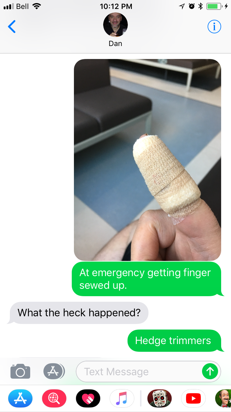 Guy can't stop cutting his finger on hedge trimmer